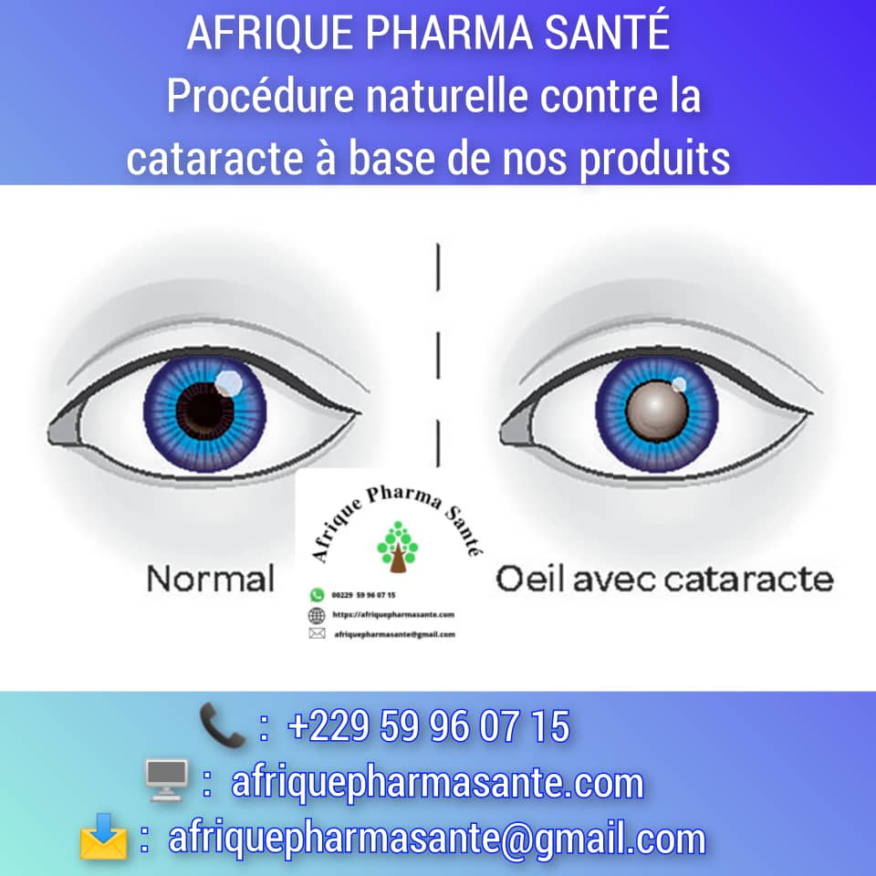 Remèdes Naturels Contre les Cataractes : La Solution d'Afrique Pharma Santé