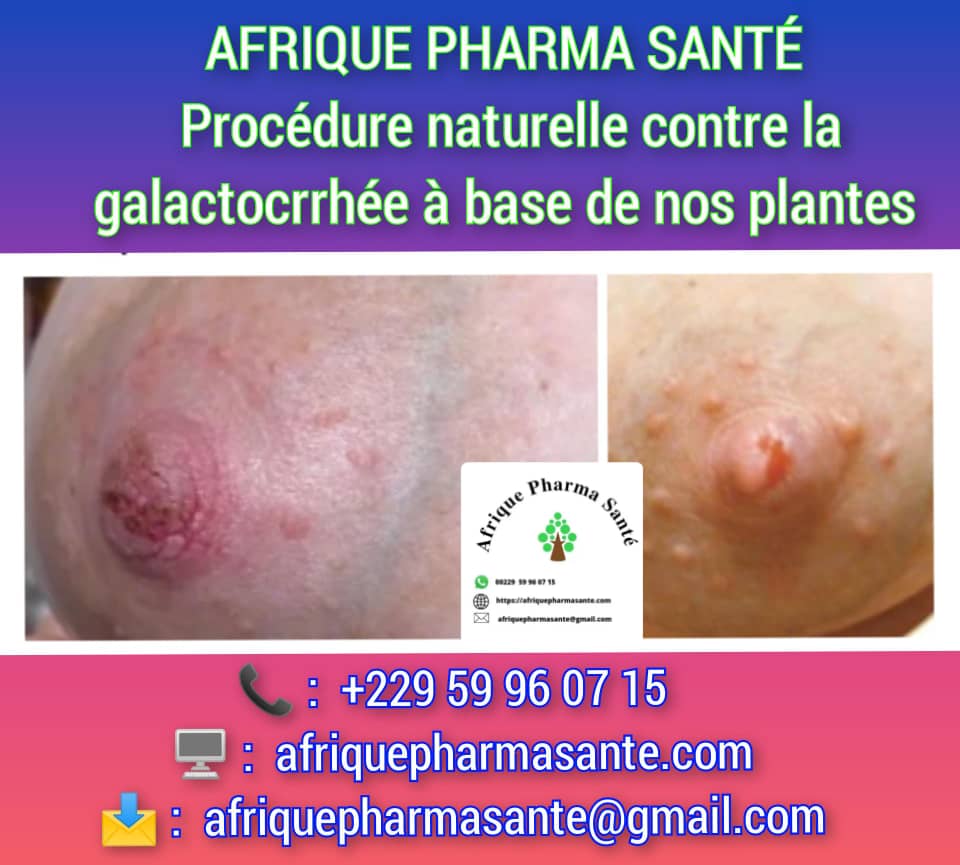 Meilleur traitement de la Galactorrhée : Identification des causes, symptômes et traitements naturels disponibles sur Afrique Pharma Santé