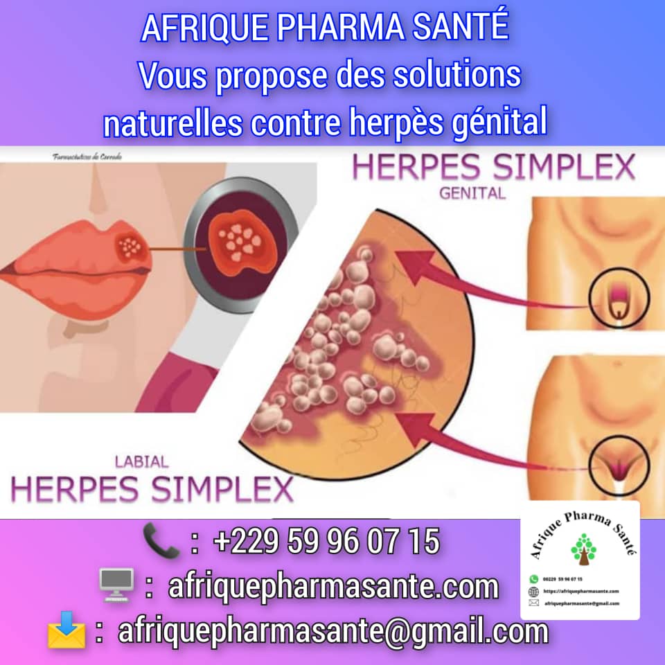 Soin pour guérir Herpès génital : Identification, causes, symptômes et traitements naturels disponibles chez Afrique Pharma Santé