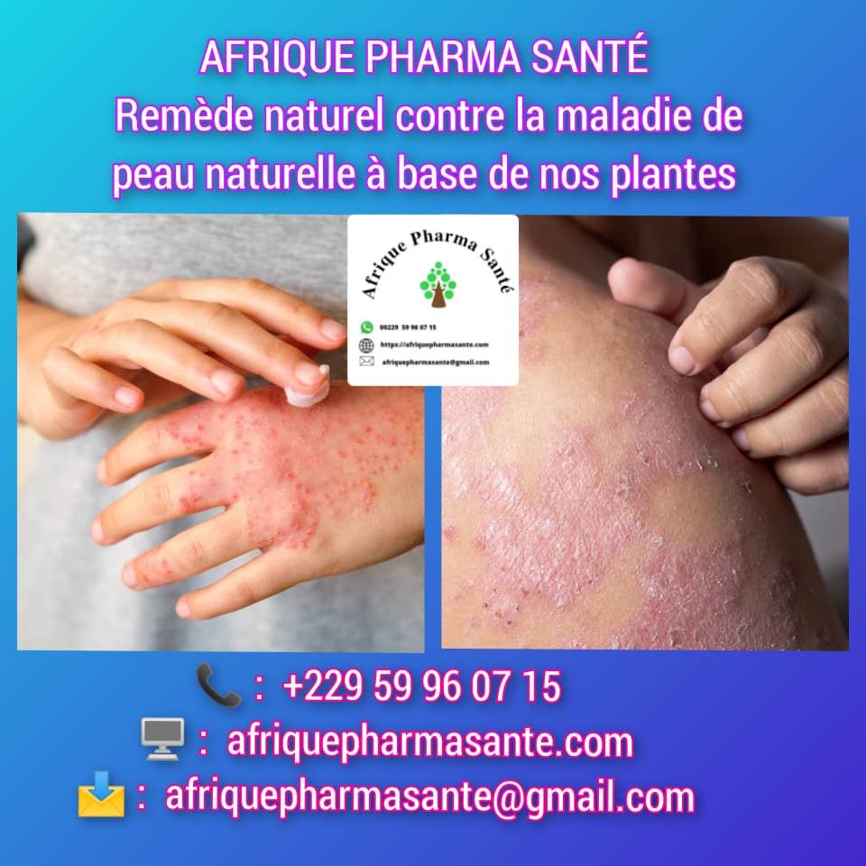 Soins Bio Contre les Maladies de Peau : Causes, Symptômes et Traitements Naturels Disponibles chez Afrique Pharma Santé