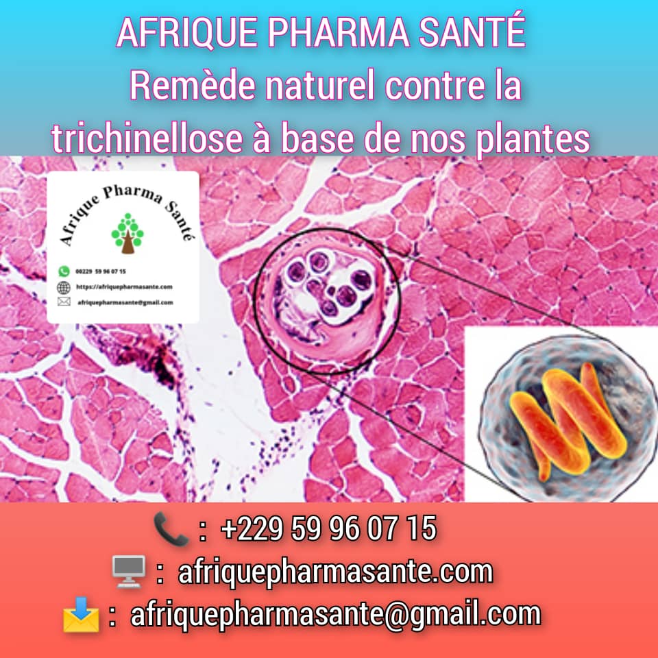 Traitement et remède Naturel Trichinellose : Causes, Symptômes et Traitement Naturel Disponible sur AFRIQUE PHARMA SANTÉ