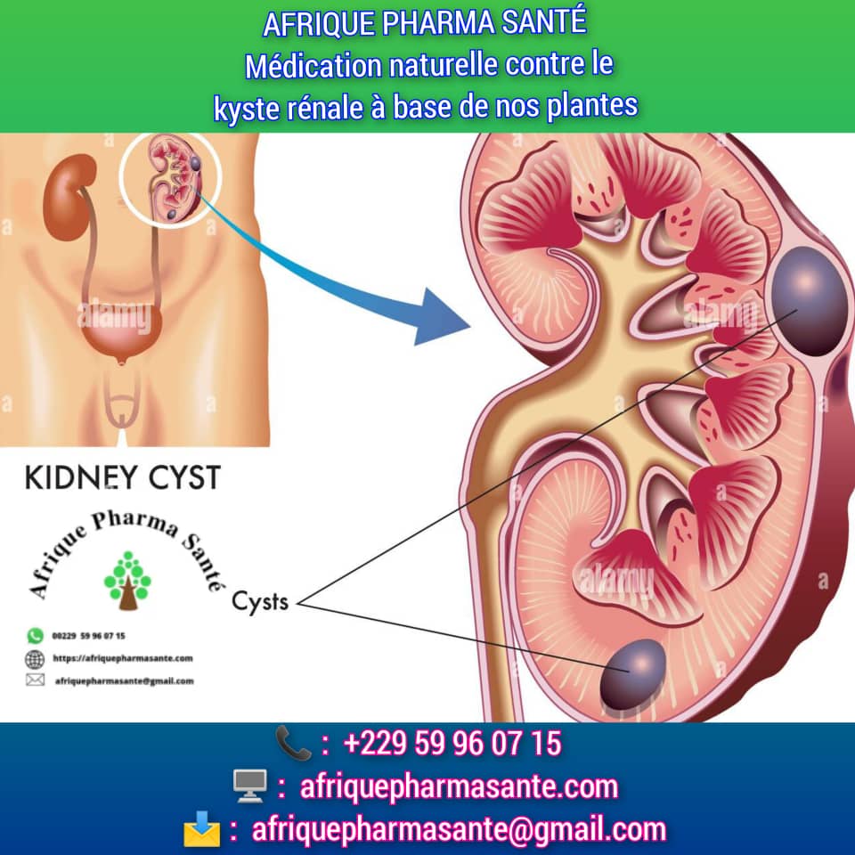 Traitement Naturel pour Kyste Rénal : Assurez une Guérison Définitive avec Afrique Pharma Santé