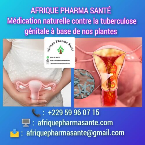 Remède 320 : Meilleur Traitement Naturel des Maladies Rares – AFRIQUE PHARMA SANTE