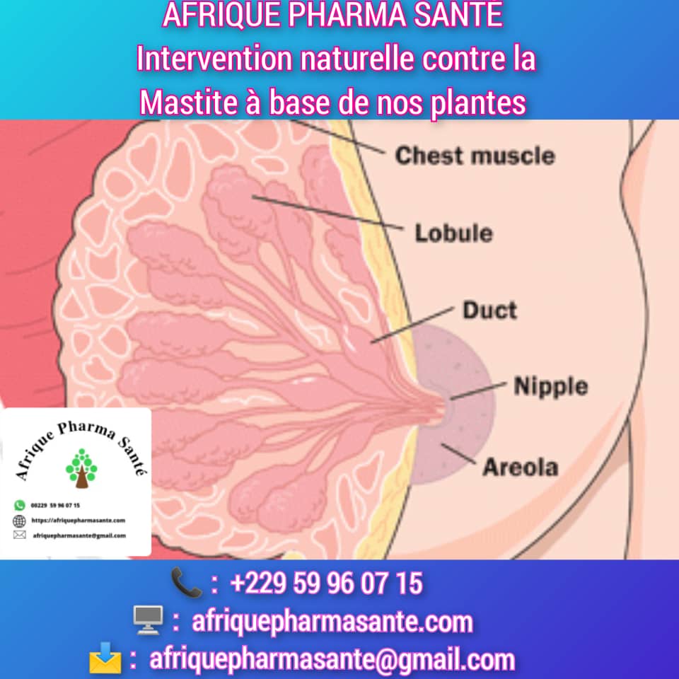 Meilleur Traitement Naturel de la Mastite : Causes, Symptômes et Remède Disponible sur Afrique Pharma Santé