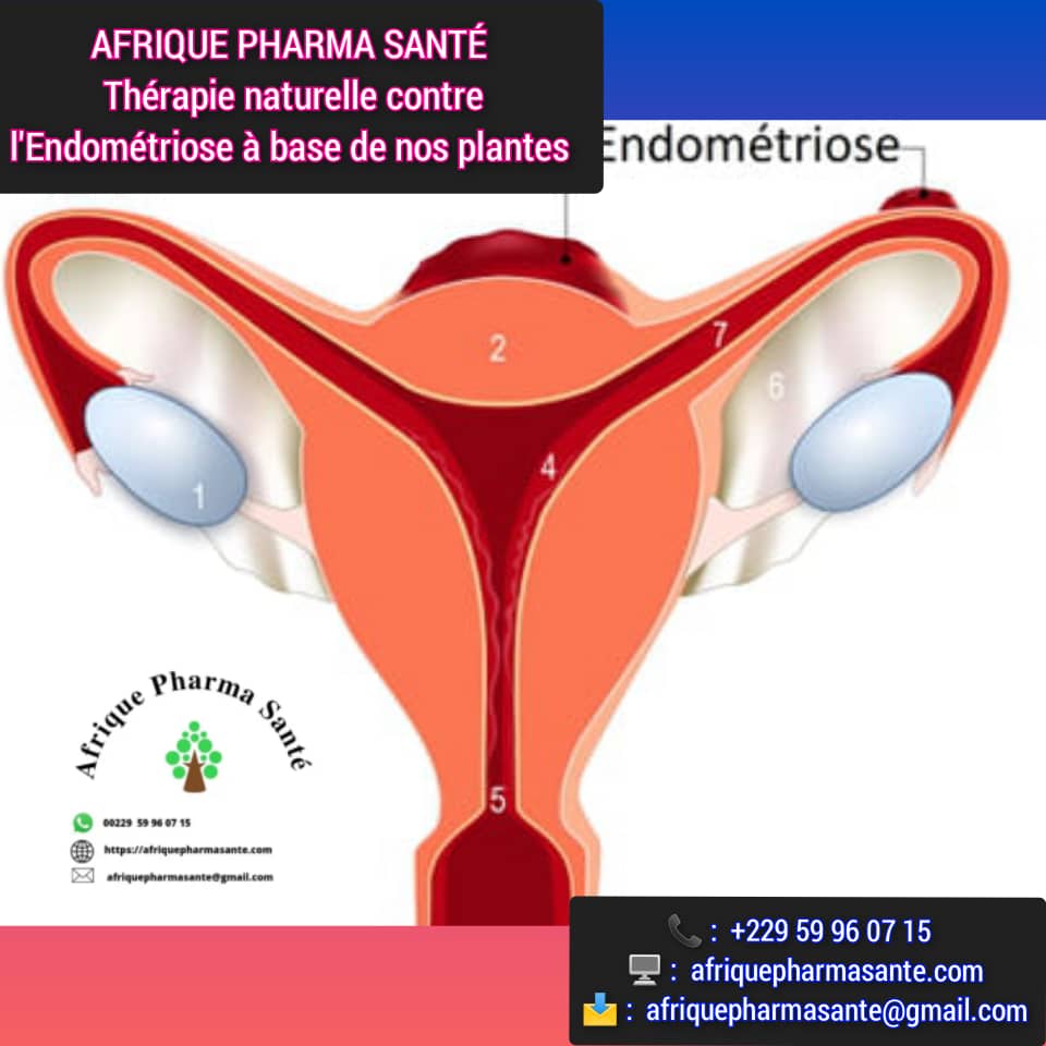 Traitement Naturel Contre l’Endométriose : Soin Bio - Solution Bio Disponible sur Afrique Pharma Santé