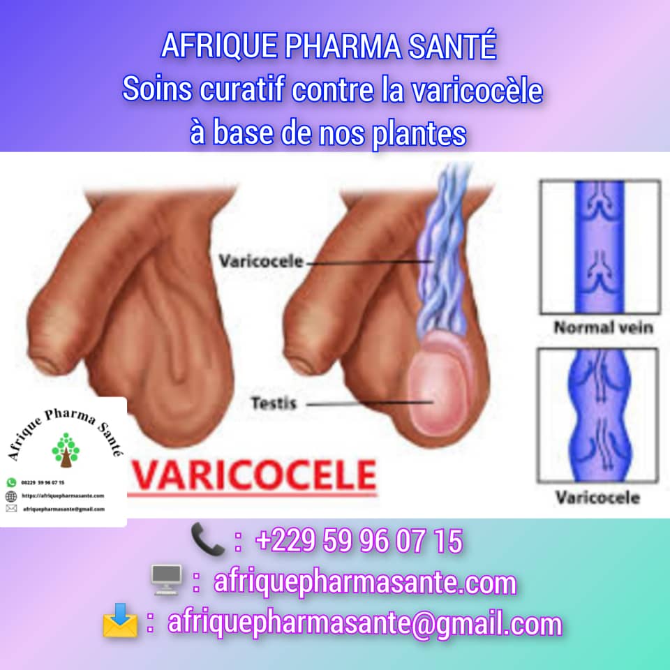 Traitement Naturel de la Varicocèle avec AFRIQUE PHARMA SANTE