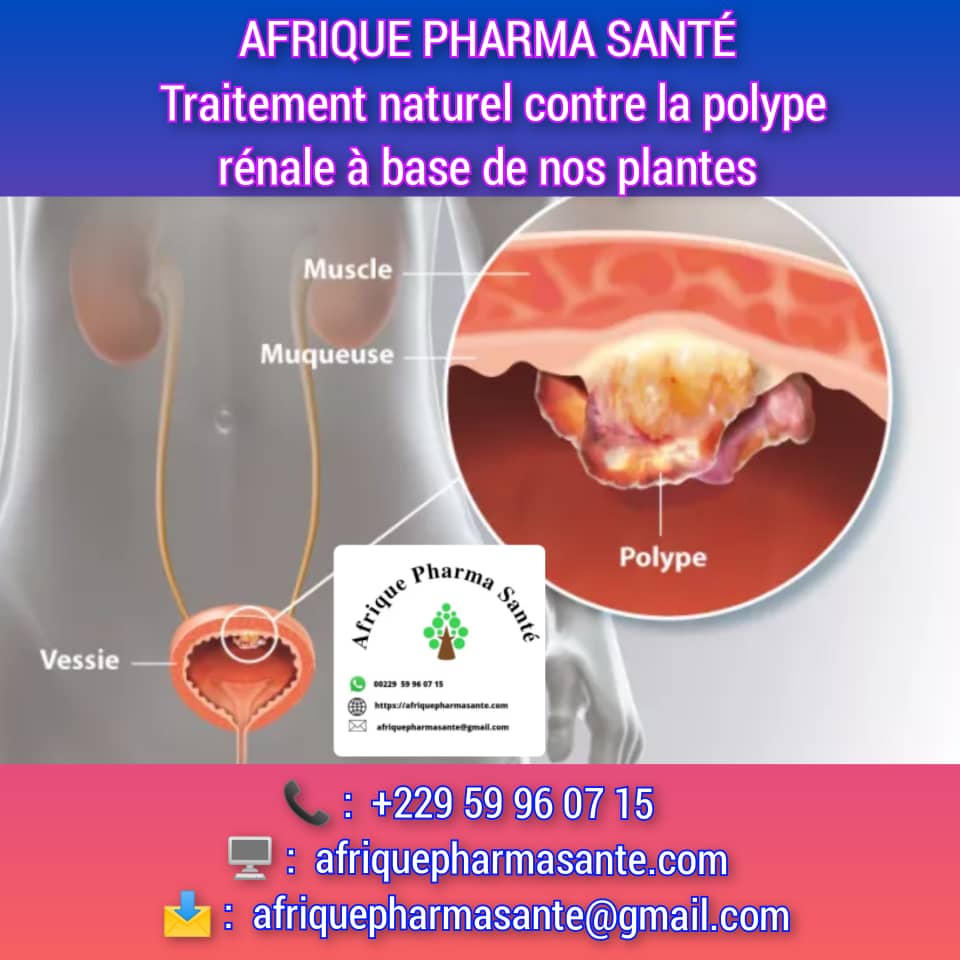 Traitement Naturel des Polypes Rénaux : Causes, Symptômes et Solution Définitive Chez Afrique Pharma Santé