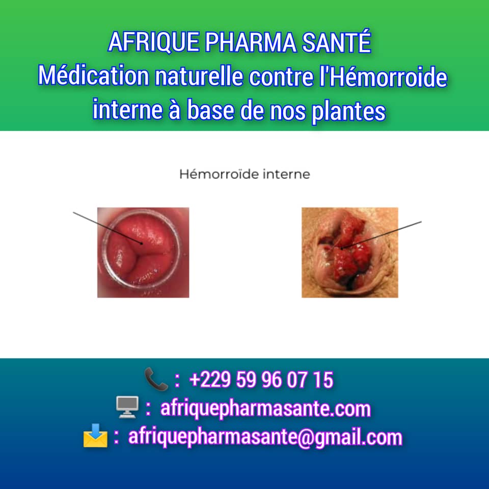 Traitement Naturel des Hémorroïdes Internes et Externes : La Solution Biologique Proposée par AFRIQUE PHARMA SANTÉ