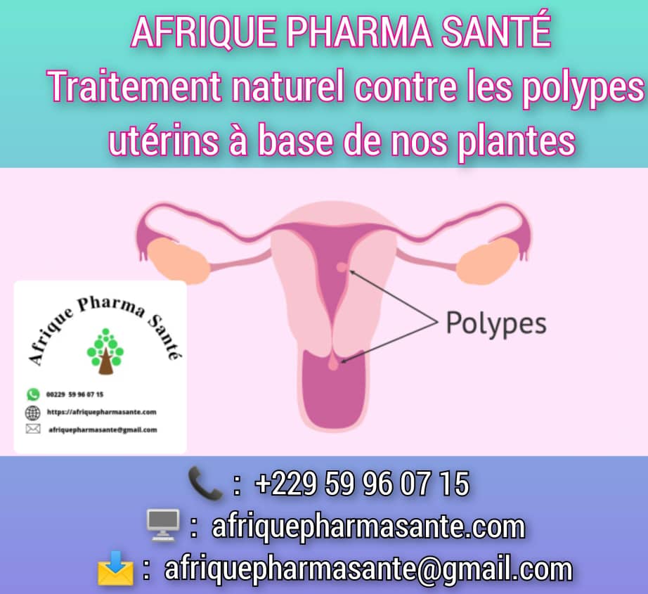 Traitement naturel polypes utérins - Tout savoir sur les polypes utérins et leur traitement définitif chez Afrique Pharma Santé