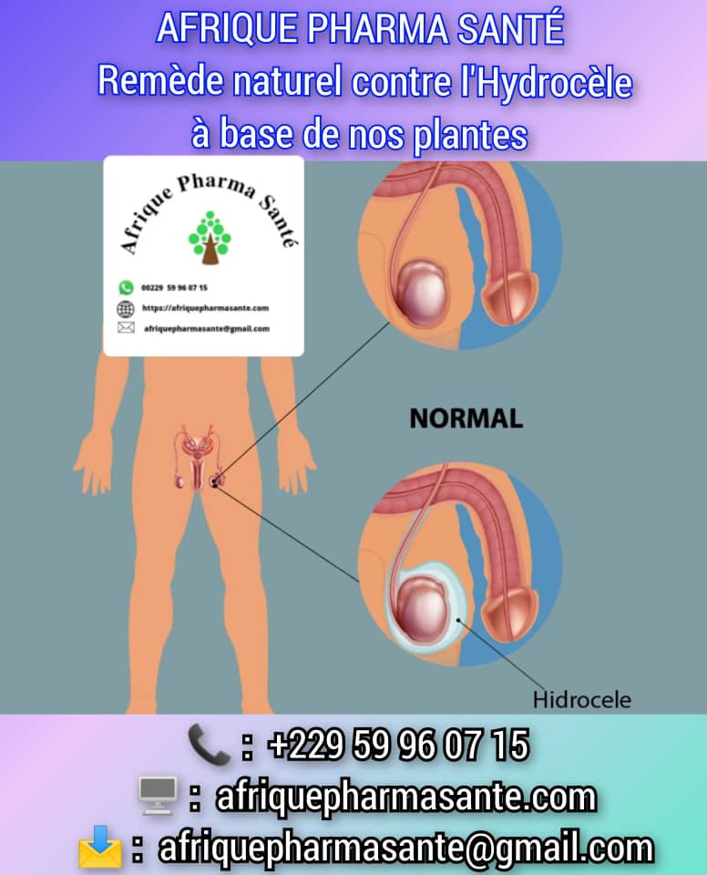 Traitement et remède bio Naturel de la Varicocèle : Une Solution Durable