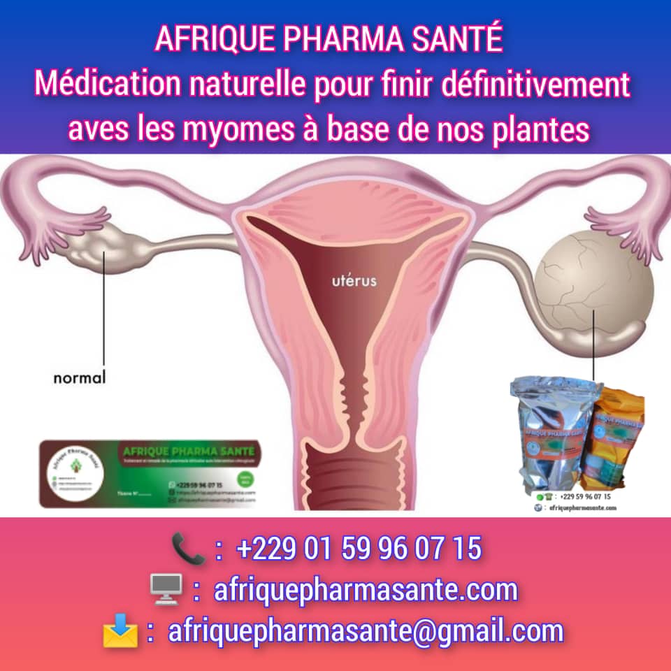 Traitement Naturel pour les Myomes et Fibromes : Une Solution Définitive chez Afrique Pharma Santé