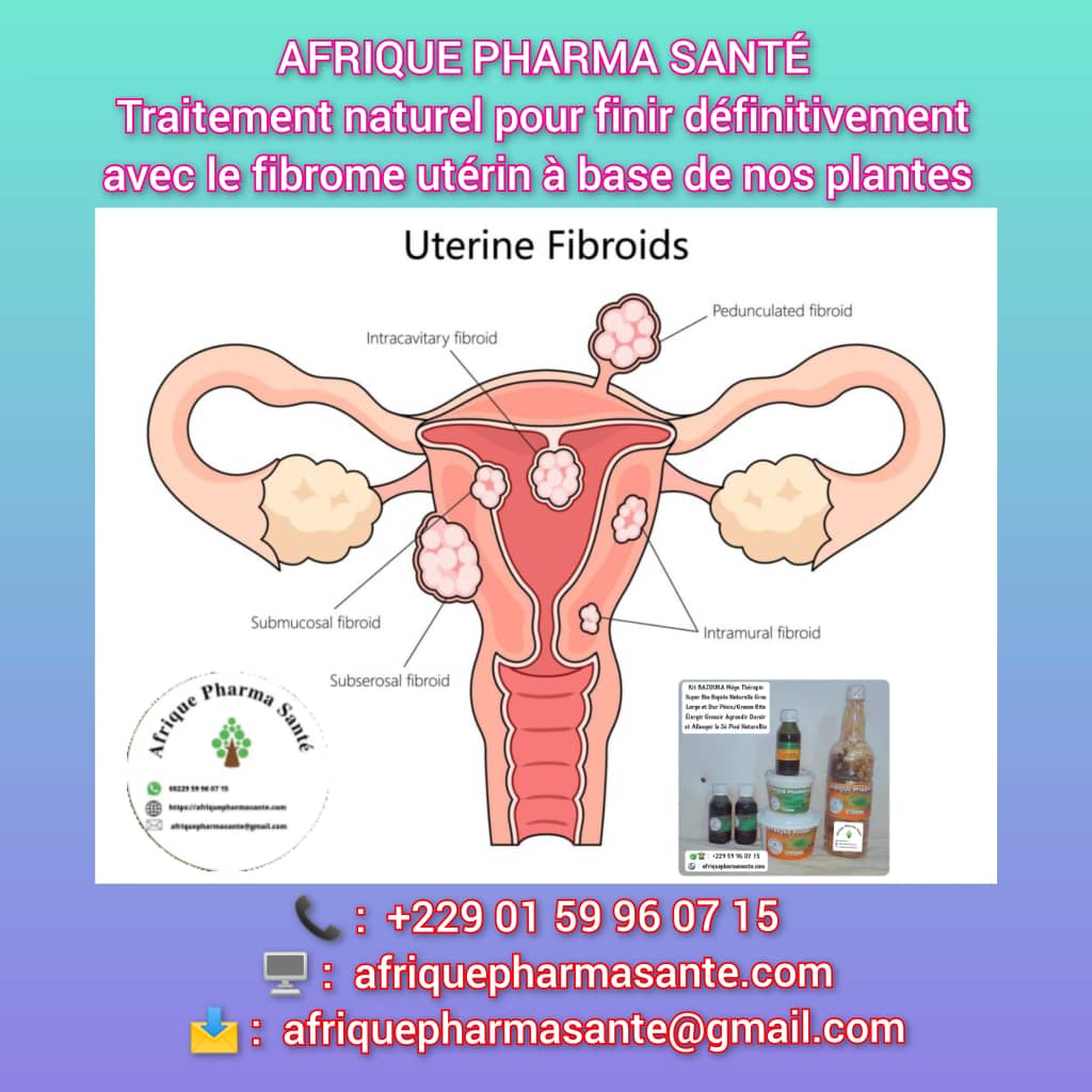 Remède naturel pour assécher les fibromes utérins