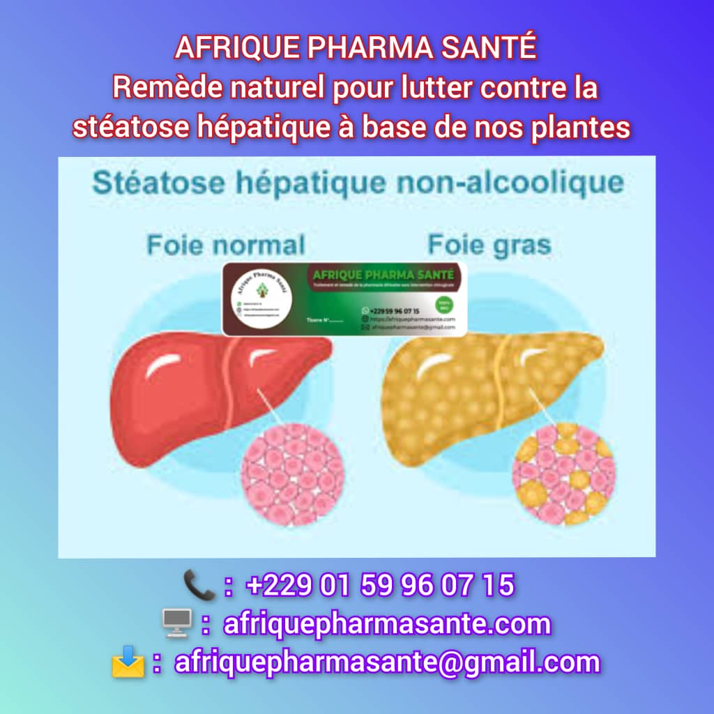 Stéatose Hépatique Traitement Naturel Définitif (Foie Gras) : Causes, Symptômes et Remède Naturel Définitif avec Docteur Afrique Pharma
