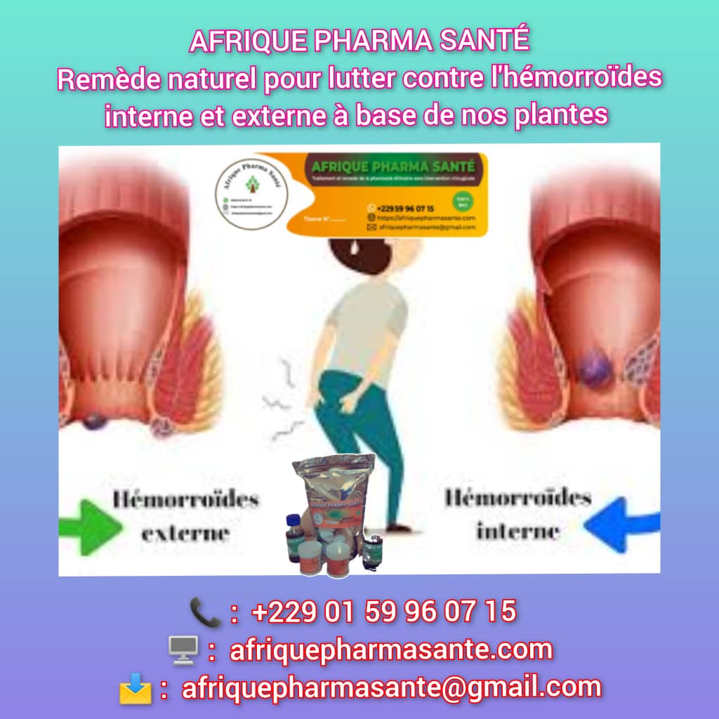Hémorroïdes internes et externes soins Naturels