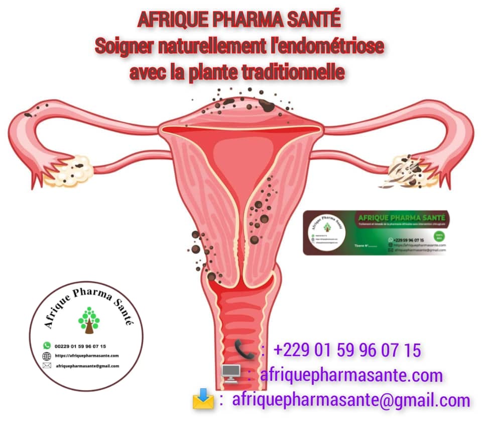 Soigner Naturellement l’Endométriose : Traitement Bio Efficace à Base de Plantes Africaines