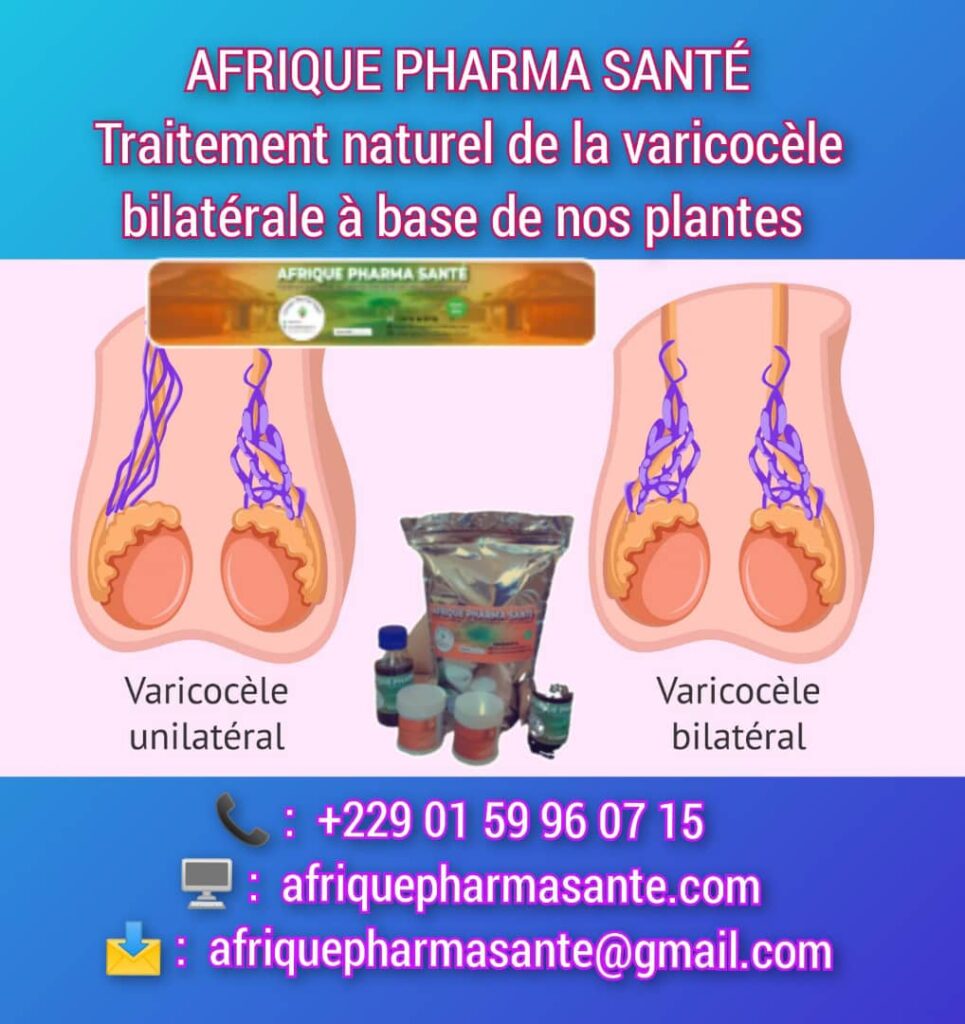 Traitement Naturel de la Varicocèle Bilatérale : Traitement Naturel Efficace Sans Chirurgie